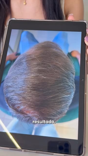 Todo antes e depois carrega uma explicação técnica por trás, e não apenas uma imagem de resultado. O