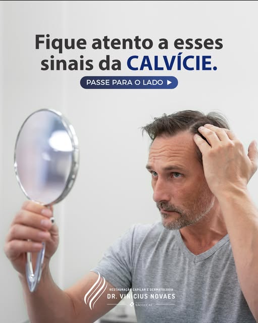 A calvície não começa quando a falha aparece. 

O primeiro sinal é quase imperceptível: o fio vai af