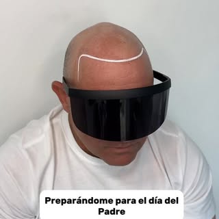 Cambio de vida con la técnica de micropigmentación capilar 🔝💎#micropigmentacioncapilar #scalpmexic