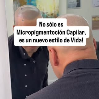 Es más que una #micropigmentacioncapilar 💎🔝