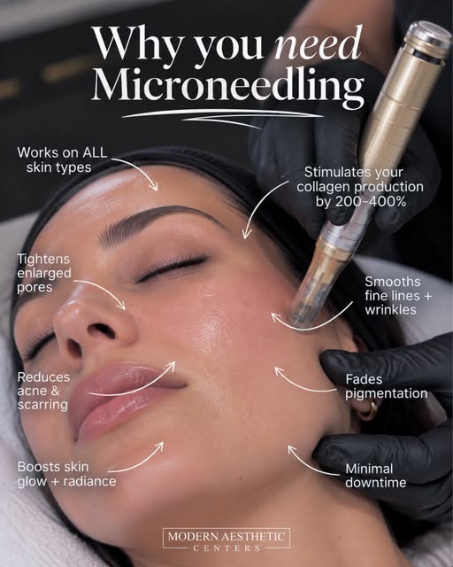 Why you need microneedling ✨

More collagen. Smoother texture. Refined pores. Softer looking fine li