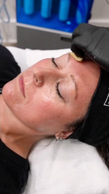 ✨ Radiant skin begins with the right approach.​

The VI Peel Precision is a powerful treatment desig