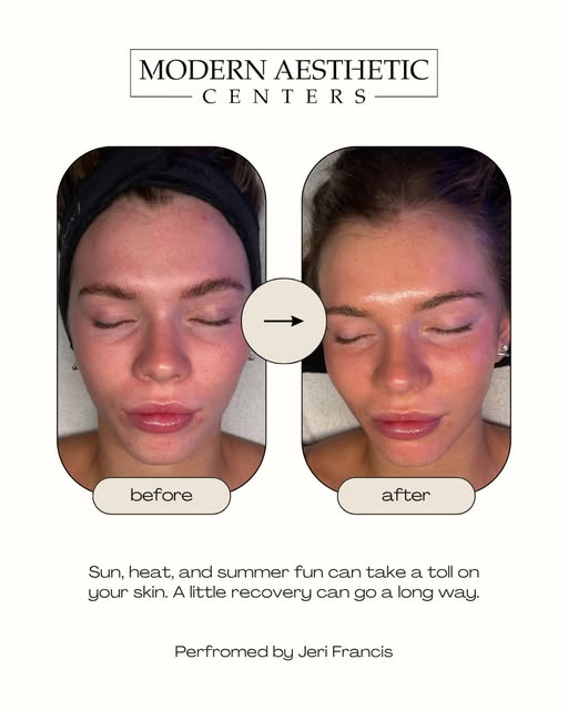 Summer may be ending, but your glow doesn't have to. 🌞​

This before & after showcases the refreshi