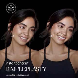 Add a natural charm to your smile ✨

Dimpleplasty is a simple cosmetic procedure that creates natura