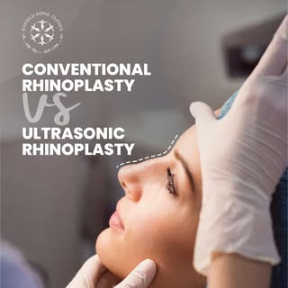 Not all rhinoplasty techniques are the same 👃✨

Dr. Naveed Azhar explains the difference between Ul
