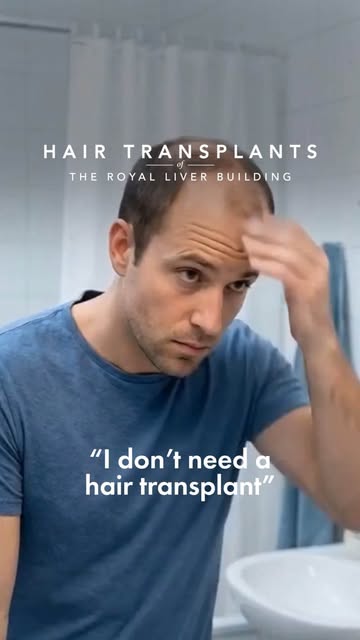 “I don’t need a hair transplant.” 😏

…“I changed my mind.” 👀✨

Sometimes seeing the difference say