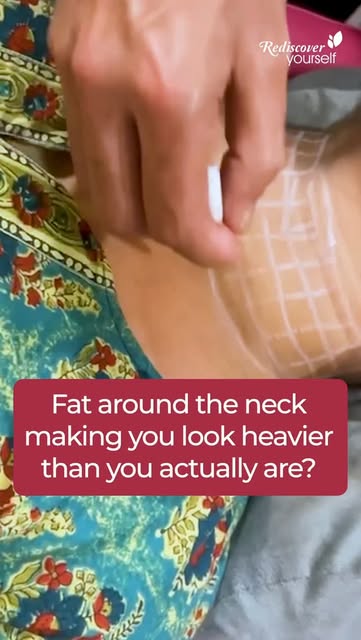 That little pocket of fat under the chin can be surprisingly stubborn.
Even with a healthy lifestyle