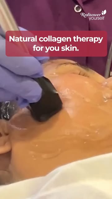 Tighten loose skin naturally with Forma RF radiofrequency treatment.

This collagen therapy works by