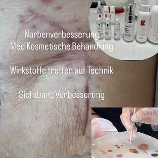 #scars #fachseminareinfos coming soon