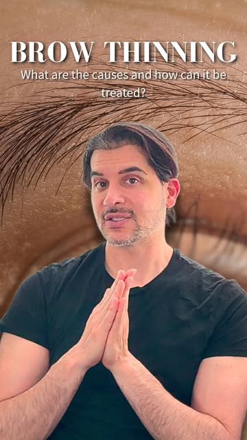 You don’t often think about your brows in regards to hair thinning, but it’s more common than you th