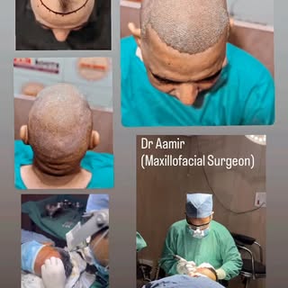 #FUE#DR AAMIR #MEERUT