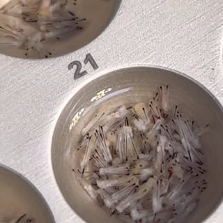 ◾️ Transplante Capilar Técnica FUE. Você conhece? Quer saber mais sobre? Comente aqui 👇🏻
.
.
.
.
.