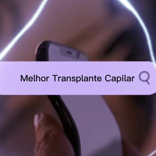 ▫️ O Transplante Capilar técnica FUE se tornou a cirurgia plástica mais procurada por homens. 

▫️ O