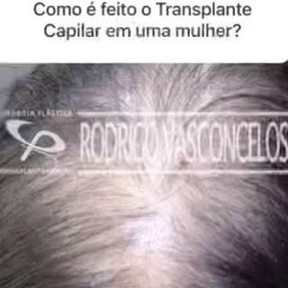 Você sabia? 
Veja até o final! Você irá se surpreender 😱

📞 Agendamento pelo telefone : (15) 3442 