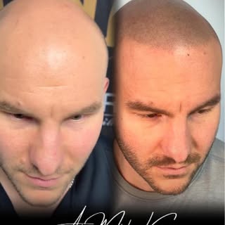 7 ans d'expériences !!! Aussi simple que PARFAIT !!

#barbershopconnect #microblading #scalp #barber