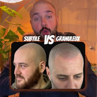 La micropigmentation capillaire naturelle & ''effet subtile'' VS ''effet granuleux'' ✨

La vraie réu