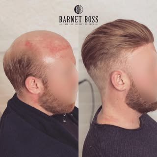 So happy with this transformation and such a nice guy to have in the hot seat, was a pleasure making