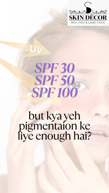 SPF 30, 50 or 100 — Is it enough to manage pigmentation? ☀️

Is a higher SPF always better? And is S