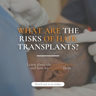 When considering a hair transplant, it’s essential to understand the potential risks involved. At Ca