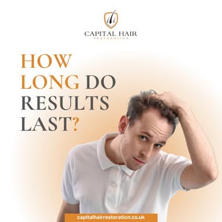 One of the most common questions we hear at Capital Hair Restoration is, "How long do hair transplan