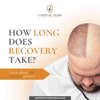 How long does recovery take? The recovery process can vary depending on individual factors and the t