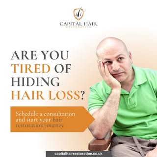 Are you tired of hiding hair loss? Living with hair loss can feel like a constant battle, affecting 