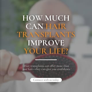 Hair transplants can offer more than just hair—they can give you confidence! The impact of hair loss