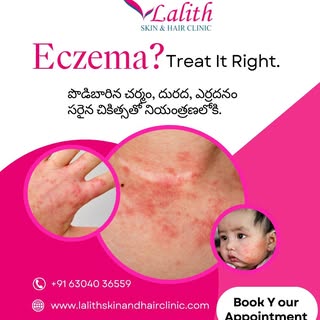 Eczema — Treat It Right

Eczema can cause dryness, itching, redness and irritation — but you don't h