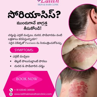 Psoriasis Awareness (Telugu)

🩺 సోరియాసిస్‌తో ఇబ్బంది పడుతున్నారా?

చర్మంపై ఎర్రటి మచ్చలు, తెల్లటి 