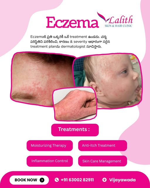 Eczema can affect everyone differently — and the right treatment depends on your skin condition, tri