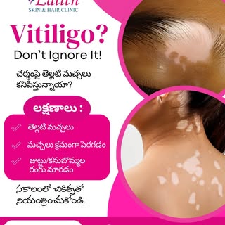 Vitiligo? Don’t Ignore It!

Notice white patches on your skin?

Vitiligo can cause noticeable change