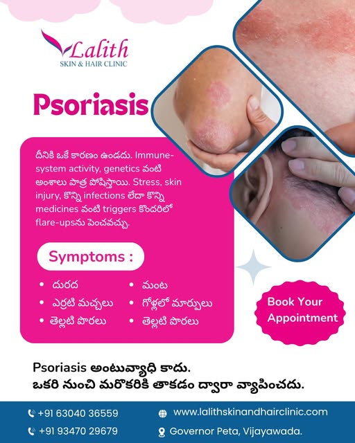 Psoriasis is not just a skin condition — it can affect your everyday comfort and confidence. 

Red, 