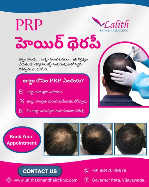 PRP therapy can help address hair thinning and support healthier-looking hair growth by using platel