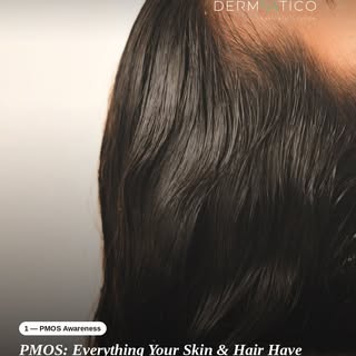 Your skin and hair are communicating. Are you listening? 
When you experience sudden jawline breakou
