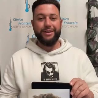 Es tu momento 😘

CLÍNICA CAPILAR FRONTELA
Zaragoza | Sevilla | Málaga | Madrid | Barcelona | Madrid
