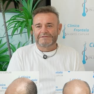 ✨ Hay cambios que van mucho más allá de lo estético.

El cambio de Juan José no solo se refleja en s