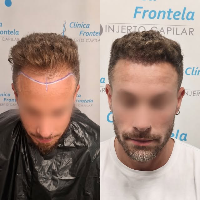 Solo depende de ti….
Nuestros pacientes siempre se preguntan
¿Porque no lo hice antes?

Zaragoza | S