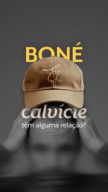 Boné não causa calvície. A calvície de padrão é genética e hormonal e aconteceria com ou
sem boné.
O