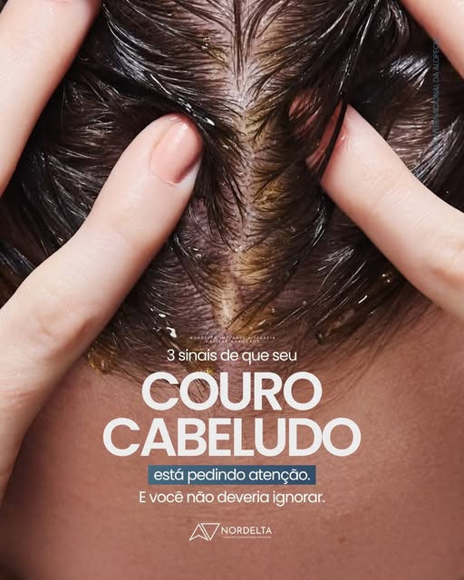 Seu couro cabeludo também precisa de cuidados!🚨
Já notou algum desses sinais?