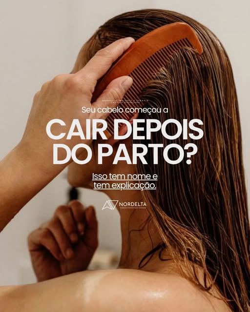 Calma que essa queda pós parto pode ser mais comum do que você está 🤔. 
O eflúvio telógeno pós-part