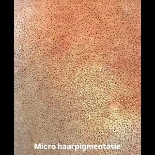 Ingezoomd werk van een micro haar pigmentatie. Ben je ook geïnteresseerd in een behandeling? Laat ee