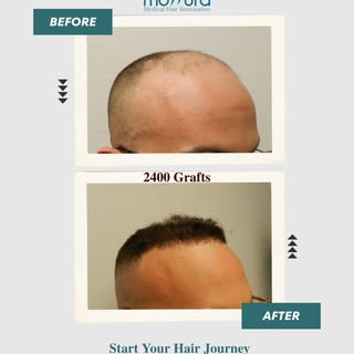 More Than Hair, It's Confidence.
Start Your Hair Journey Today!
