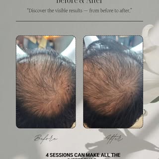 💁‍♀️
Where clients feel the satisfaction first — Grow On Scalp Care🌿