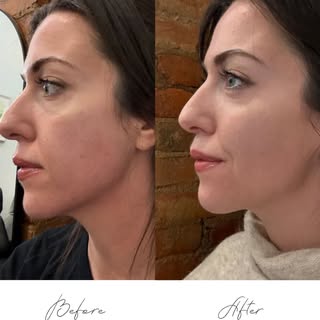 👀 Can you spot the difference?

No makeup and no filter in either photo. This transformation came f