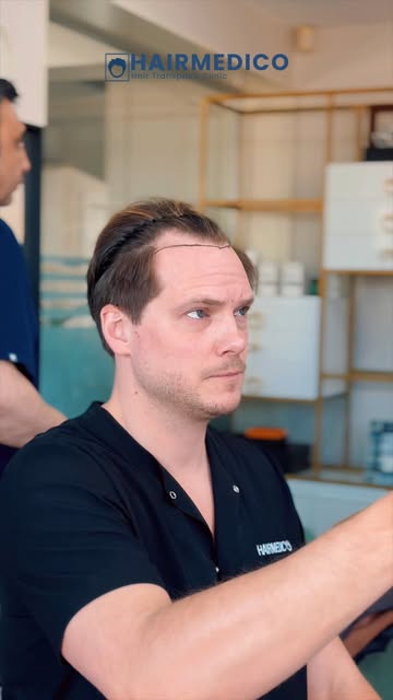 A hair transplant is not just about adding grafts — it’s about creating a result that looks natural,