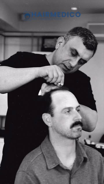A successful hair transplant starts long before the first graft is placed — it starts with the right