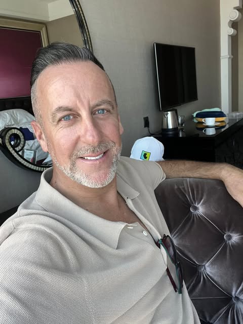 Showing the results from my hair transplant at @surabayahairtrans  Honestly the very best in the bus