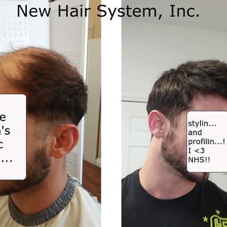 Before and after photo of #newhairsystem client. Stylin' and profilin'! #cutin-service #cut-in #hair