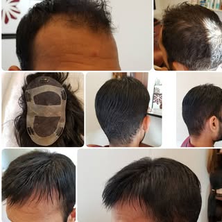 top 2 photos are the before photos. custom clip-in hair system and cut-in service.
.
.
.
.
.
#newhai