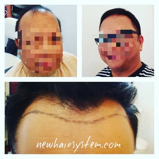 placement is just as important as the lace front wig itself.
.
.
.
.
.
#newhairsystem #customhair #c